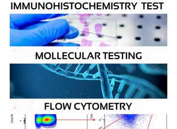 Biopsy Steps