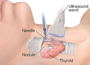 procedure